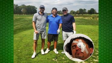 Jaime Moreno perdió un ojo